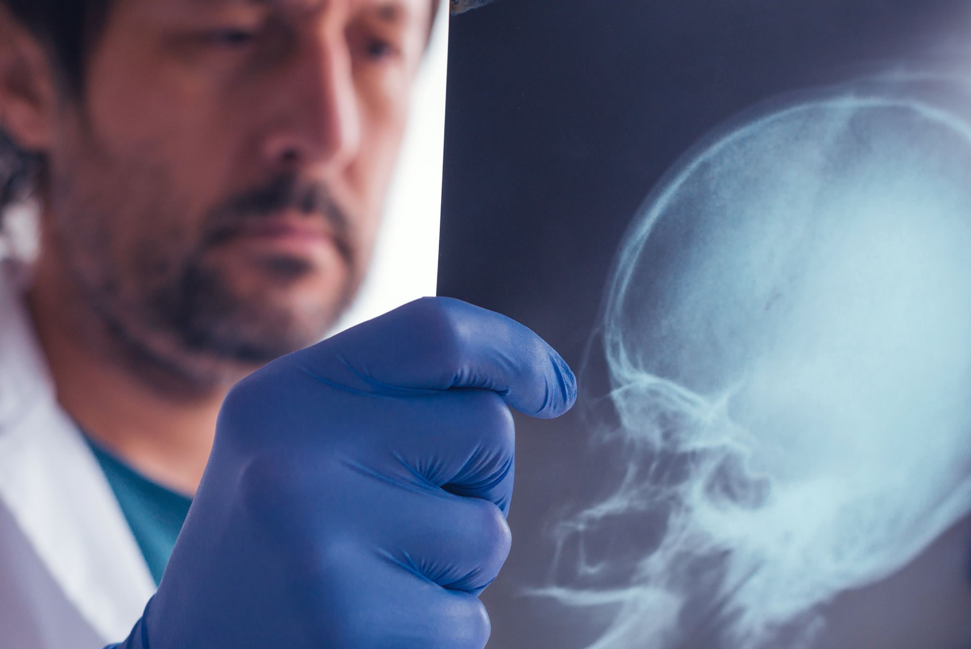 examining x-ray of skull - brain/head injury claim compensation solicitors Stockport