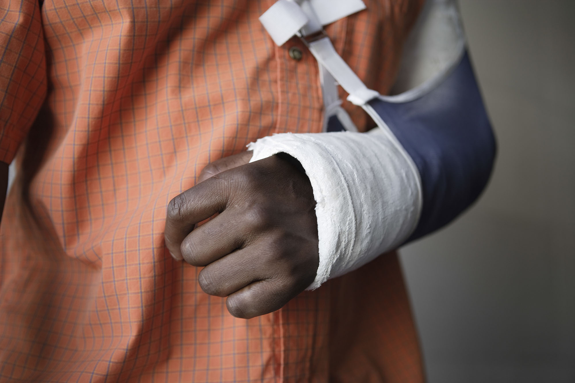 arm injury compensation claim solicitors of Stockport
